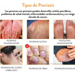 🌿✨Kolmax™ | ⛔️¡ADIÓS PICAZÓN! Tratamiento en aerosol para PSORIASIS 🌿