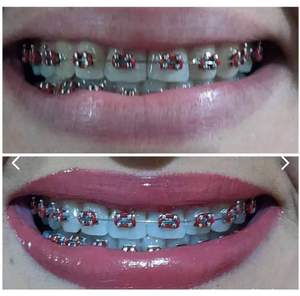 Crema Dental Blanqueadora